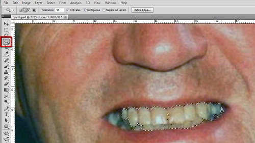 Using the magic want tool to make a selection of the teeth